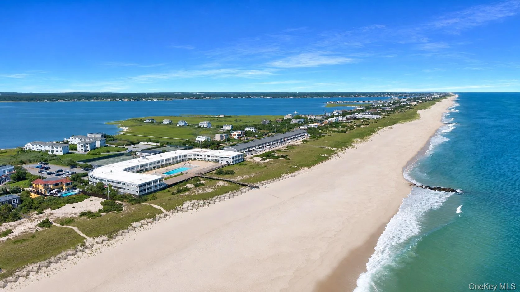Photograph of 585 Dune Road